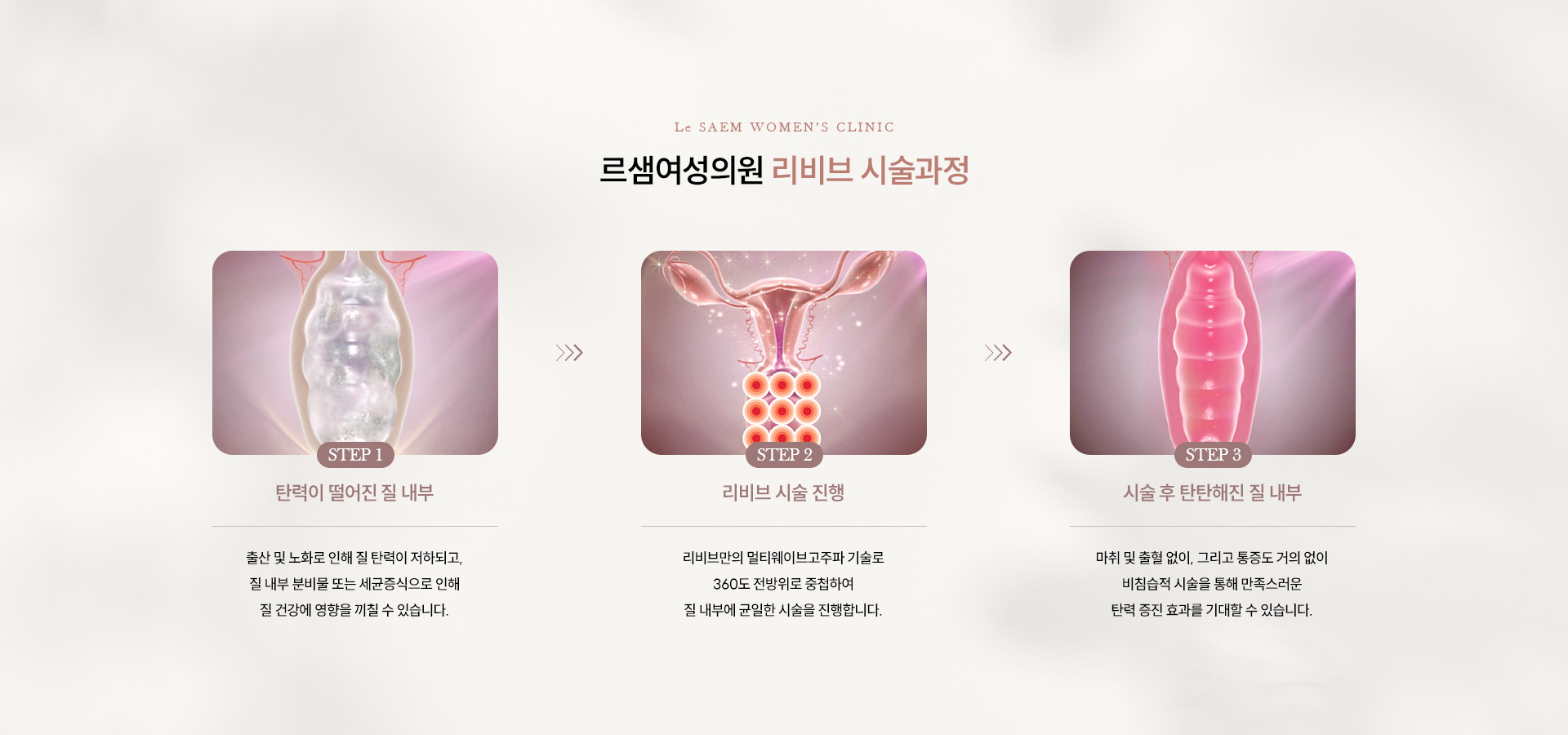 질타이트닝·질건조클리닉 06